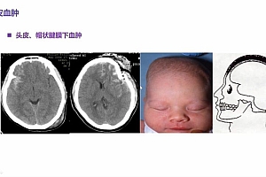 丁香园:手把手教你读懂头颅 CT【共10节】【全】【298元】 百度网盘(3.79G)