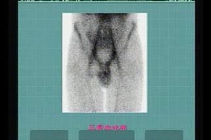 丁香园:MRI大全 百度网盘(23.43G)