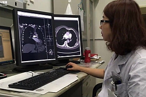 丁香园:影像学读片技巧 百度网盘(3.60G)