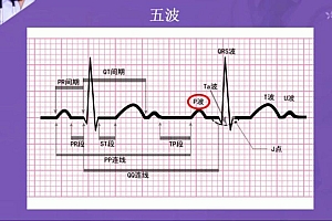 丁香园:快速读懂心电图【共21节】【全】【388元】 百度网盘(11.72G)