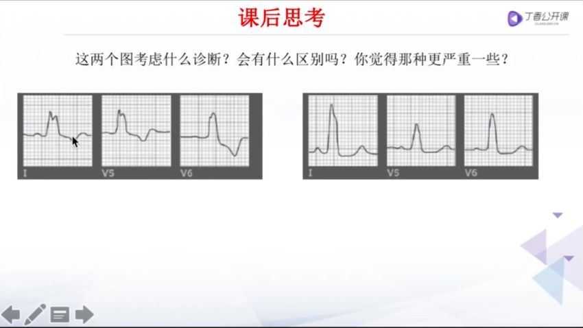 丁香园：危急重症心电图198元 百度网盘(2.15G)