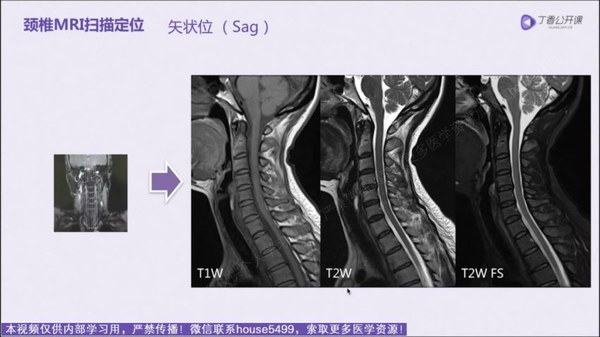 丁香园：脊柱MRI进阶指南【共11节】【全】【248元】 百度网盘(8.65G)